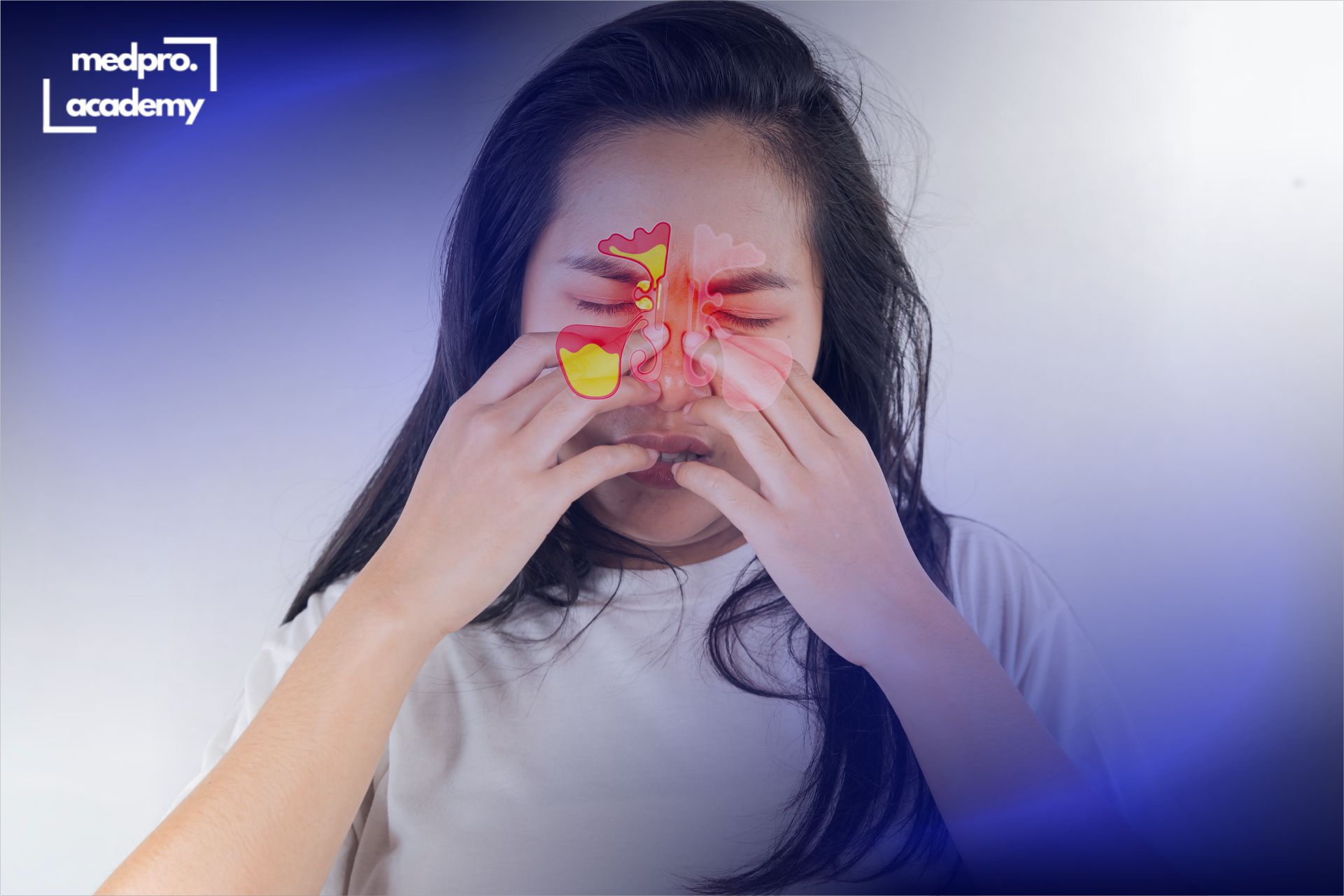 1Синусити типові помилки лікування та покази до хірургії